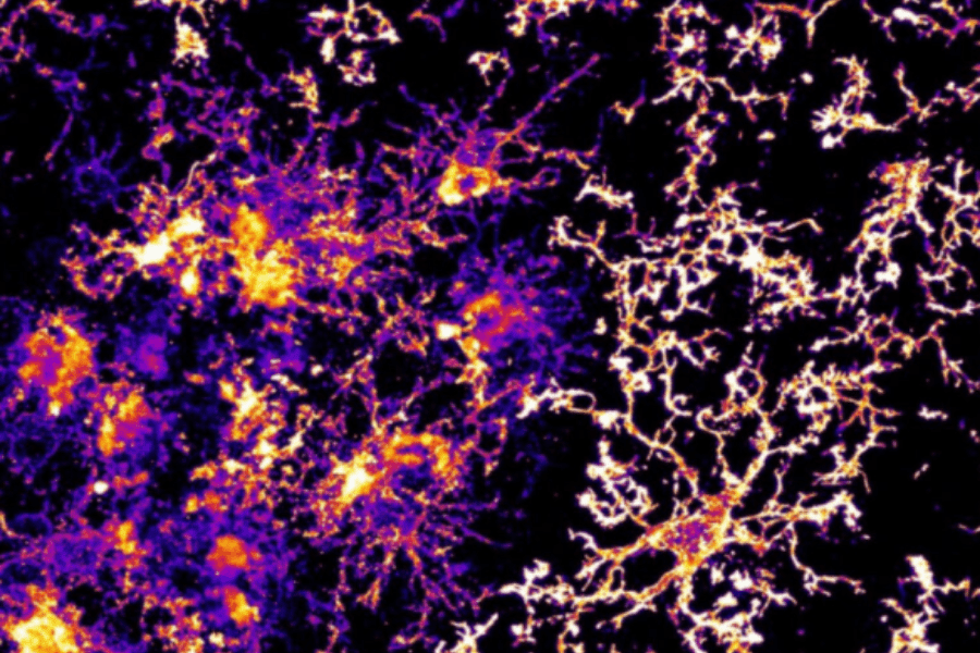 Alzheimer's Funding